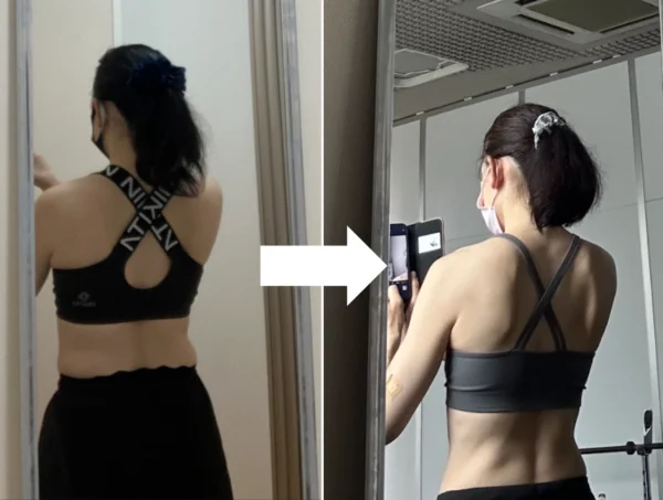 ダイエット後は贅肉がなくなり、丸かった背中がシャープになった